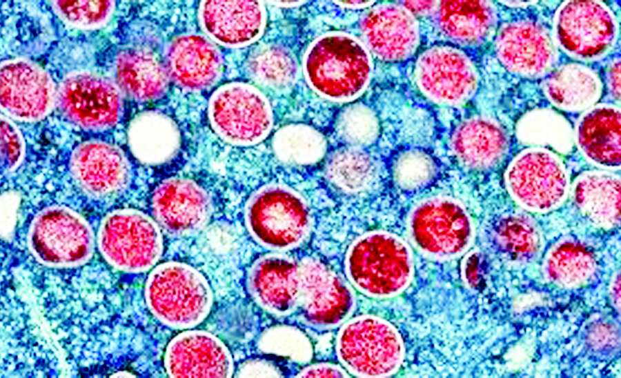 ဆောင်းပါး