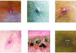 ဆောင်းပါး